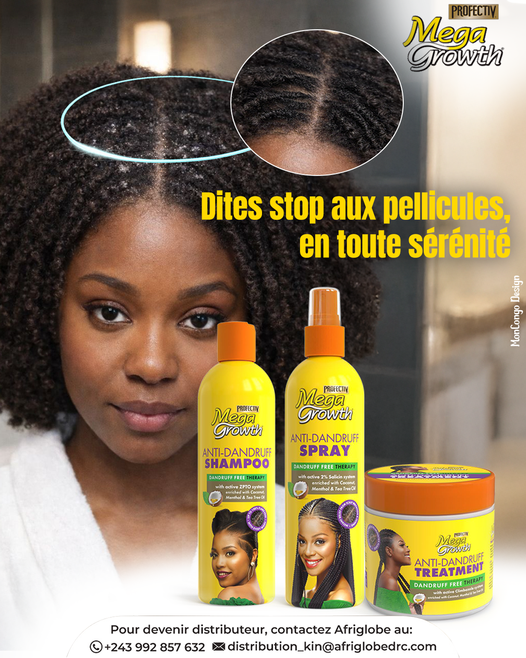 Dites stop aux pellicules, en toute sérénité