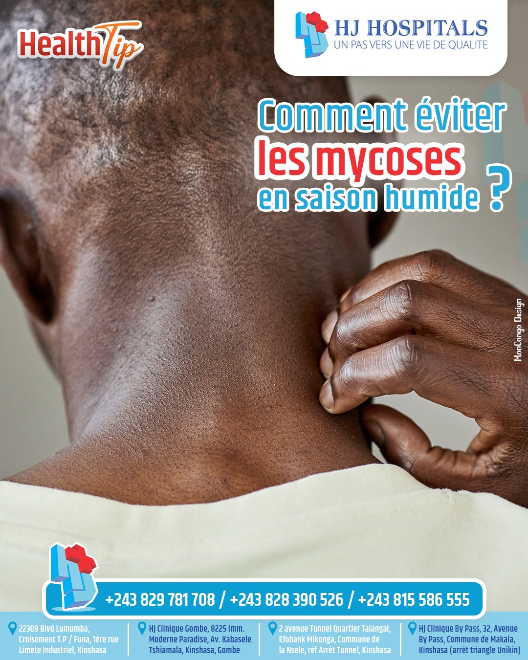  Comment éviter les mycoses en saison humide ?