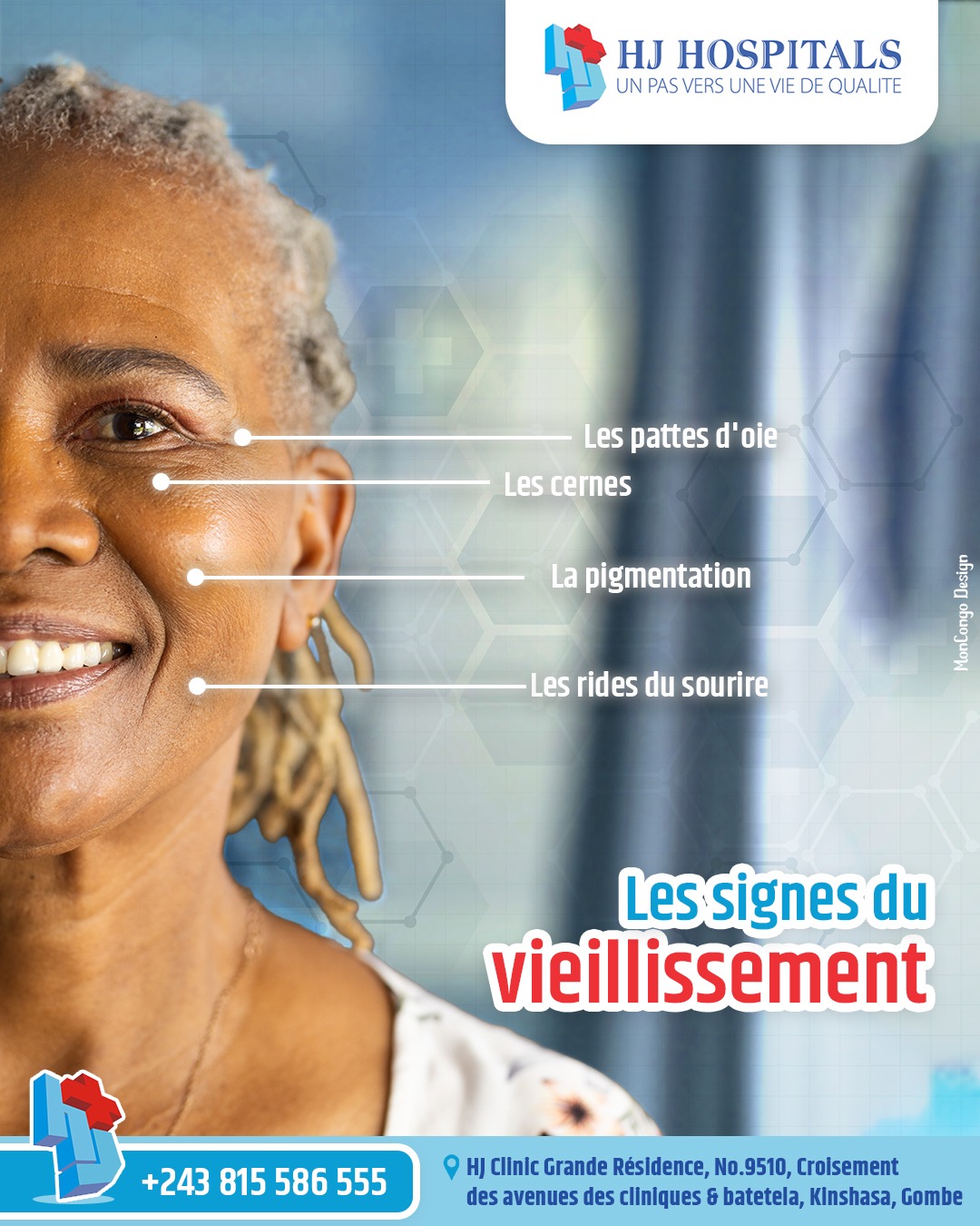 Les signes du vieillissement
